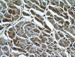 LIMK1 Antibody in Immunohistochemistry (Paraffin) (IHC (P))