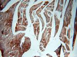 NEB Antibody in Immunohistochemistry (Paraffin) (IHC (P))