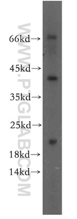 neurturin Antibody in Western Blot (WB)