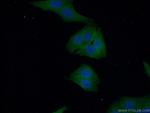 PYGM Antibody in Immunocytochemistry (ICC/IF)