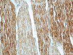 PYGM Antibody in Immunohistochemistry (Paraffin) (IHC (P))