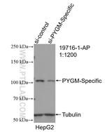 PYGM Antibody in Western Blot (WB)