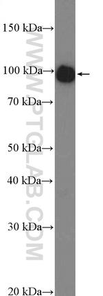 PYGM Antibody in Western Blot (WB)