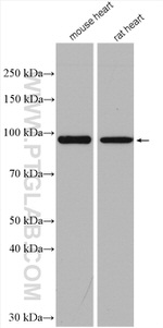 PYGM Antibody in Western Blot (WB)