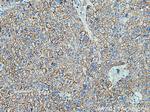 SPTBN1 Antibody in Immunohistochemistry (Paraffin) (IHC (P))