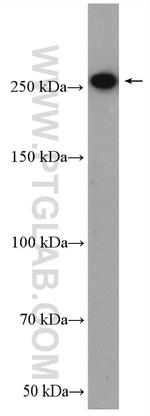 SPTBN1 Antibody in Western Blot (WB)