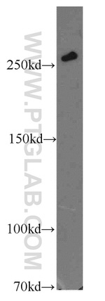 SPTBN1 Antibody in Western Blot (WB)