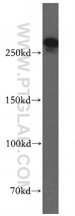 SPTBN1 Antibody in Western Blot (WB)