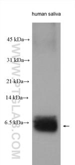 STATH Antibody in Western Blot (WB)