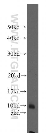 STATH Antibody in Western Blot (WB)