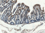 Thrombospondin 3 Antibody in Immunohistochemistry (Paraffin) (IHC (P))