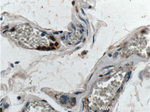 Thrombospondin 3 Antibody in Immunohistochemistry (Paraffin) (IHC (P))