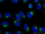 TMF1 Antibody in Immunocytochemistry (ICC/IF)