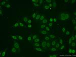 TMF1 Antibody in Immunocytochemistry (ICC/IF)