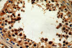 TMF1 Antibody in Immunohistochemistry (Paraffin) (IHC (P))