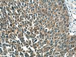 TMF1 Antibody in Immunohistochemistry (Paraffin) (IHC (P))