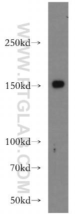 TMF1 Antibody in Western Blot (WB)