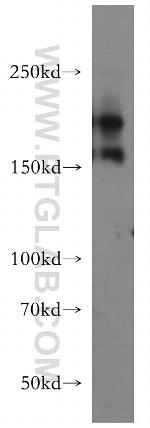 Tenascin-R Antibody in Western Blot (WB)
