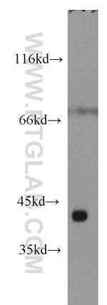 ST8SIA2 Antibody in Western Blot (WB)