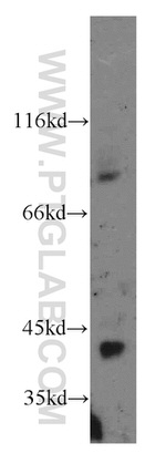 ST8SIA2 Antibody in Western Blot (WB)