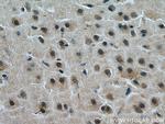 KALRN Antibody in Immunohistochemistry (Paraffin) (IHC (P))