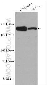 KALRN Antibody in Western Blot (WB)