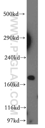 KALRN Antibody in Western Blot (WB)