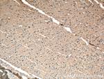 KALRN Antibody in Immunohistochemistry (Paraffin) (IHC (P))