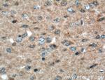 KALRN Antibody in Immunohistochemistry (Paraffin) (IHC (P))