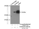 RAB11B Antibody in Immunoprecipitation (IP)