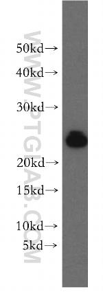 RAB11B Antibody in Western Blot (WB)