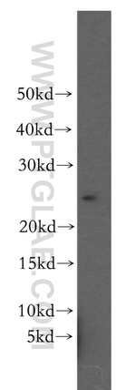 RAB11B Antibody in Western Blot (WB)