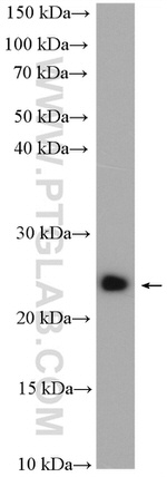 RAB11B Antibody in Western Blot (WB)