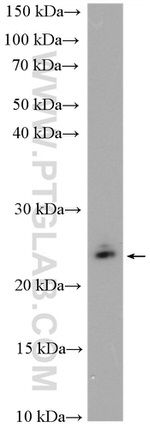 RAB11B Antibody in Western Blot (WB)