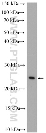 RAB11B Antibody in Western Blot (WB)