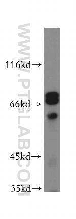 WASF4 Antibody in Western Blot (WB)