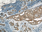 LATH Antibody in Immunohistochemistry (Paraffin) (IHC (P))