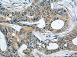 LATH Antibody in Immunohistochemistry (Paraffin) (IHC (P))