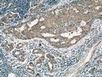 LATH Antibody in Immunohistochemistry (Paraffin) (IHC (P))