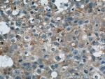 LATH Antibody in Immunohistochemistry (Paraffin) (IHC (P))