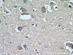 RYR2 Antibody in Immunohistochemistry (Paraffin) (IHC (P))