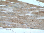 RYR2 Antibody in Immunohistochemistry (Paraffin) (IHC (P))