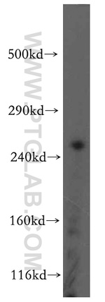 RYR2 Antibody in Western Blot (WB)