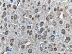 ADRA1B Antibody in Immunohistochemistry (Paraffin) (IHC (P))