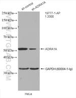 ADRA1A Antibody in Western Blot (WB)