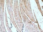 AMPD1 Antibody in Immunohistochemistry (Paraffin) (IHC (P))