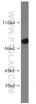 AMPD1 Antibody in Western Blot (WB)