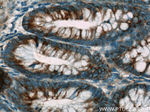 APC Antibody in Immunohistochemistry (Paraffin) (IHC (P))