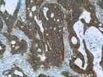 APC Antibody in Immunohistochemistry (Paraffin) (IHC (P))