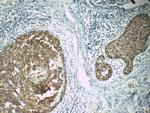 APC Antibody in Immunohistochemistry (Paraffin) (IHC (P))